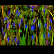 Immunofluorescence image of dental pulp stem cells labeled with DSHB antibody 3CB2 against Vimentin. PMID: 29370163, Fig. 5D.
